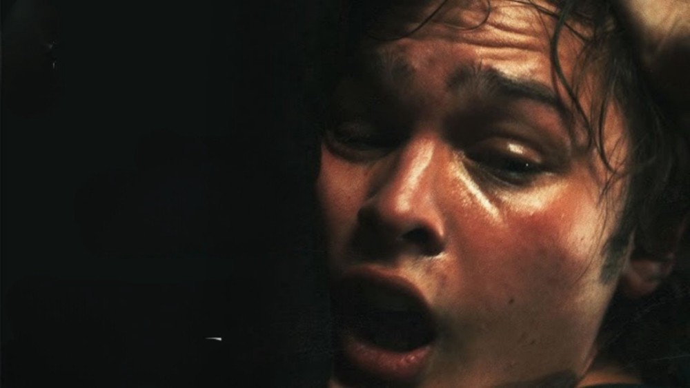 Chảy máu - Bleeding